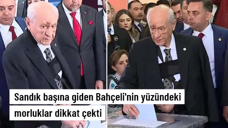 BAHÇELİ GİDİCİ Mİ AMA MAKAMDAN AMA DÜNYADAN!