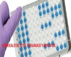 KIRIKKALE HALKINA TEDAVİDE HİLTİ YAKIŞIR.